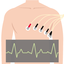 ③心電図検査